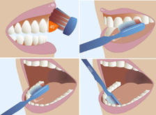 limpieza dental