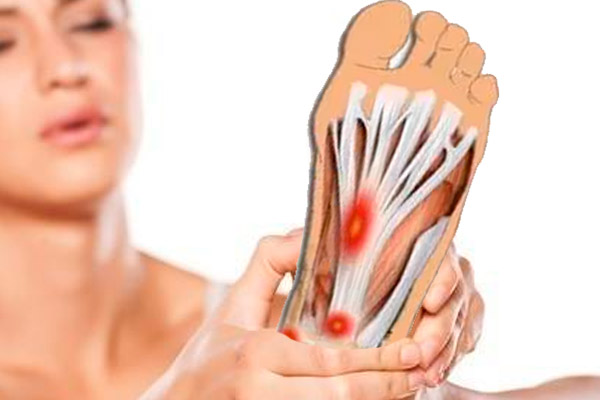 Fascitis plantar consigue alivio para el dolor de pies