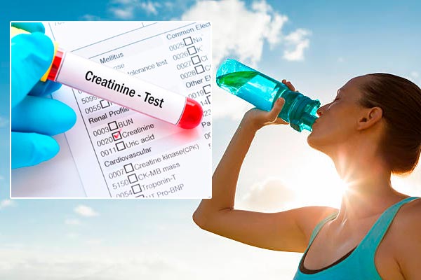 Creatinina alta, como se puede controlar con alimentos