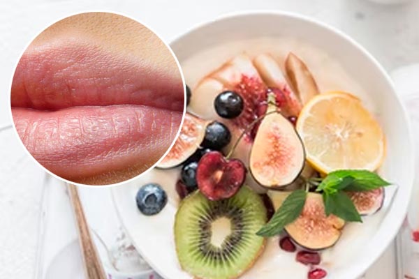 Herpes labial dietas y recetas caseras