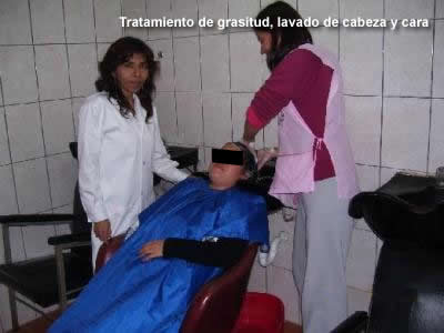 Tratamiento de grasitud, lavado de cabeza y cara