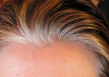 canas remedios caseros canas mujeres