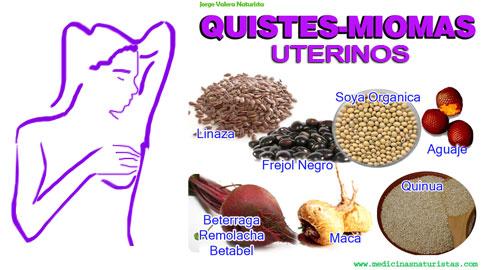 miomas quistes uterirnos